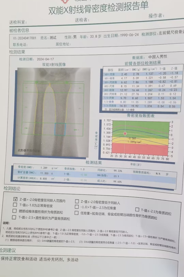 雙能X射線骨密度儀：準確測量骨密度，助力骨質(zhì)疏松防治，守護骨骼健康